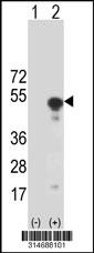 Western blot analysis of his-tag ACTL7A (arrow) using his tag antibody. 293 cell lysates (2 ug/lane) either nontransfected (Lane 113) or transiently transfected with theACTL7A gene.
