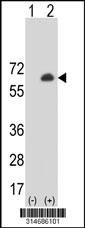 Western blot analysis of his-tag ARRDC1 (arrow) using his tag antibody. 293 cell lysates (2 ug/lane) either nontransfected (Lane 181) or transiently transfected with theARRDC1 gene.