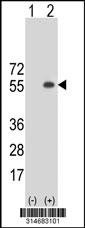 Western blot analysis of his-tag SPZ1 (arrow) using his tag antibody. 293 cell lysates (2 ug/lane) either nontransfected (Lane 188) or transiently transfected with theSPZ1 gene.