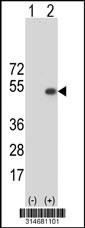 Western blot analysis of his-tag LRRC42 (arrow) using his tag antibody. 293 cell lysates (2 ug/lane) either nontransfected (Lane 100) or transiently transfected with theLRRC42 gene.