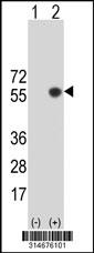 Western blot analysis of his-tag CHST8 (arrow) using his tag antibody. 293 cell lysates (2 ug/lane) either nontransfected (Lane 85) or transiently transfected with theCHST8 gene.