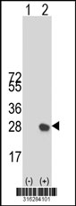 Western blot analysis of his-tag LITAF (arrow) using his tag antibody. 293T cell lysates (2 ug/lane) either nontransfected (Lane 1) or transiently transfected with the LITAF gene‘