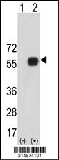 Western blot analysis of his-tag HPN (arrow) using his tag antibody. 293 cell lysates (2 ug/lane) either nontransfected (Lane 151) or transiently transfected with theHPN gene.