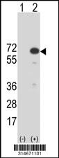 Western blot analysis of his-tag FLJ10404 (arrow) using his tag antibody. 293 cell lysates (2 ug/lane) either nontransfected (Lane 63) or transiently transfected with theFLJ10404 gene.