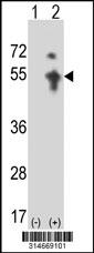 Western blot analysis of his-tag USP25 (arrow) using his tag antibody. 293 cell lysates (2 ug/lane) either nontransfected (Lane 126) or transiently transfected with theUSP25 gene.