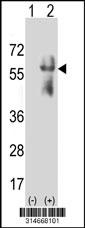Western blot analysis of his-tag LILRB4 (arrow) using his tag antibody. 293 cell lysates (2 ug/lane) either nontransfected (Lane 157) or transiently transfected with theLILRB4 gene.