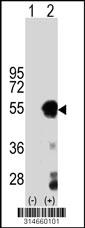 Western blot analysis of his-tag VAT1L (arrow) using his tag antibody. 293 cell lysates (2 ug/lane) either nontransfected (Lane 185) or transiently transfected with theVAT1L gene.