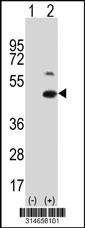 Western blot analysis of his-tag STRADB (arrow) using his tag antibody. 293 cell lysates (2 ug/lane) either nontransfected (Lane 56) or transiently transfected with theSTRADB gene.