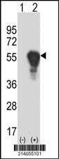 Western blot analysis of his-tag EVL (arrow) using his tag antibody. 293 cell lysates (2 ug/lane) either nontransfected (Lane 182) or transiently transfected with theEVL gene.