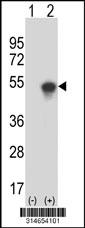 Western blot analysis of his-tag C20orf3 (arrow) using his tag antibody. 293 cell lysates (2 ug/lane) either nontransfected (Lane 25) or transiently transfected with theC20orf3 gene.