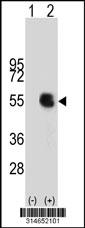 Western blot analysis of his-tag PSTPIP1 (arrow) using his tag antibody. 293 cell lysates (2 ug/lane) either nontransfected (Lane 61) or transiently transfected with thePSTPIP1 gene.
