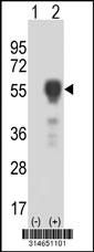 Western blot analysis of his-tag KLF15 (arrow) using his tag antibody. 293 cell lysates (2 ug/lane) either nontransfected (Lane 200) or transiently transfected with theKLF15 gene.