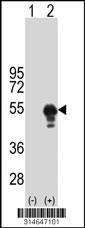 Western blot analysis of his-tag ARFGAP1 (arrow) using his tag antibody. 293 cell lysates (2 ug/lane) either nontransfected (Lane 165) or transiently transfected with theARFGAP1 gene.