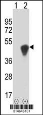 Western blot analysis of his-tag ACTL7B (arrow) using his tag antibody. 293 cell lysates (2 ug/lane) either nontransfected (Lane 187) or transiently transfected with theACTL7B gene.
