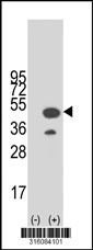 Western blot analysis of his-tag TP53I3 (arrow) using his tag antibody. 293T cell lysates (2 ug/lane) either nontransfected (Lane 1) or transiently transfected with the TP53I3 gene‘