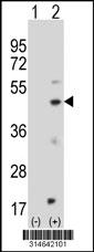 Western blot analysis of his-tag HCFC2 (arrow) using his tag antibody. 293 cell lysates (2 ug/lane) either nontransfected (Lane 47) or transiently transfected with theHCFC2 gene.