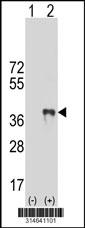 Western blot analysis of his-tag RSBN1 (arrow) using his tag antibody. 293 cell lysates (2 ug/lane) either nontransfected (Lane 154) or transiently transfected with theRSBN1 gene.