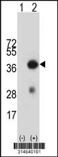 Western blot analysis of his-tag CHST1 (arrow) using his tag antibody. 293 cell lysates (2 ug/lane) either nontransfected (Lane 147) or transiently transfected with theCHST1 gene.