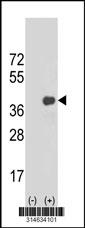 Western blot analysis of his-tag SLC25A31 (arrow) using his tag antibody. 293 cell lysates (2 ug/lane) either nontransfected (Lane 144) or transiently transfected with theSLC25A31 gene.