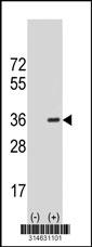 Western blot analysis of his-tag FAM82B (arrow) using his tag antibody. 293 cell lysates (2 ug/lane) either nontransfected (Lane 71) or transiently transfected with theFAM82B gene.