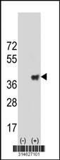 Western blot analysis of his-tag GPSN2 (arrow) using his tag antibody. 293 cell lysates (2 ug/lane) either nontransfected (Lane 19) or transiently transfected with theGPSN2 gene.