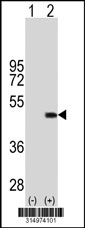 Western blot analysis of his-tag SERPINB4 (arrow) using his tag antibody. 293T cell lysates (2 ug/lane) either nontransfected (Lane 1) or transiently transfected with the SERPINB4 gene‘