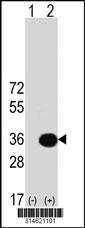 Western blot analysis of his-tag HEY1 (arrow) using his tag antibody. 293 cell lysates (2 ug/lane) either nontransfected (Lane 15) or transiently transfected with theHEY1 gene.