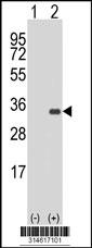 Western blot analysis of his-tag NUS1 (arrow) using his tag antibody. 293 cell lysates (2 ug/lane) either nontransfected (Lane 98) or transiently transfected with theNUS1 gene.