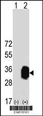 Western blot analysis of his-tag C1orf190 (arrow) using his tag antibody. 293 cell lysates (2 ug/lane) either nontransfected (Lane 191) or transiently transfected with theC1orf190 gene.