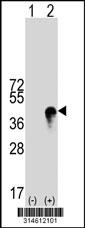 Western blot analysis of his-tag MEOX2 (arrow) using his tag antibody. 293 cell lysates (2 ug/lane) either nontransfected (Lane 1) or transiently transfected with the MEOX2 gene.