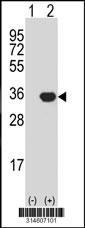 Western blot analysis of his-tag NMRAL1 (arrow) using his tag antibody. 293 cell lysates (2 ug/lane) either nontransfected (Lane 23) or transiently transfected with theNMRAL1 gene.