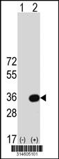 Western blot analysis of his-tag C6orf106 (arrow) using his tag antibody. 293 cell lysates (2 ug/lane) either nontransfected (Lane 18) or transiently transfected with theC6orf106 gene.