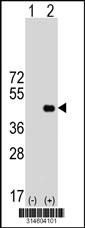 Western blot analysis of his-tag POLL (arrow) using his tag antibody. 293 cell lysates (2 ug/lane) either nontransfected (Lane 26) or transiently transfected with thePOLL gene.