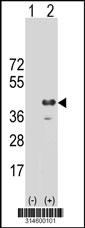 Western blot analysis of his-tag STX4 (arrow) using his tag antibody. 293 cell lysates (2 ug/lane) either nontransfected (Lane 20) or transiently transfected with theSTX4 gene.