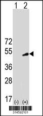 Western blot analysis of his-tag C16orf53 (arrow) using his tag antibody. 293 cell lysates (2 ug/lane) either nontransfected (Lane 27) or transiently transfected with theC16orf53 gene.