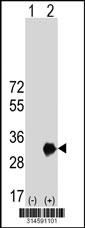 Western blot analysis of his-tag PSME1 (arrow) using his tag antibody. 293 cell lysates (2 ug/lane) either nontransfected (Lane 3) or transiently transfected with thePSME1 gene.