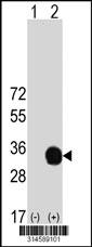 Western blot analysis of his-tag NRIP3 (arrow) using his tag antibody. 293 cell lysates (2 ug/lane) either nontransfected (Lane 65) or transiently transfected with theNRIP3 gene.