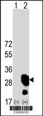 Western blot analysis of his-tag ROPN1L (arrow) using his tag antibody. 293 cell lysates (2 ug/lane) either nontransfected (Lane 112) or transiently transfected with theROPN1L gene.