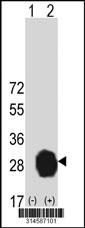 Western blot analysis of his-tag CCDC134 (arrow) using his tag antibody. 293 cell lysates (2 ug/lane) either nontransfected (Lane 134) or transiently transfected with theCCDC134 gene.