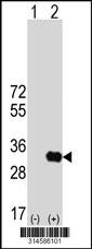 Western blot analysis of his-tag DRAP1 (arrow) using his tag antibody. 293 cell lysates (2 ug/lane) either nontransfected (Lane 74) or transiently transfected with theDRAP1 gene.