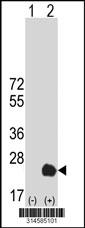 Western blot analysis of his-tag COMMD9 (arrow) using his tag antibody. 293 cell lysates (2 ug/lane) either nontransfected (Lane 81) or transiently transfected with theCOMMD9 gene.