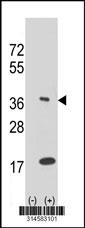 Western blot analysis of his-tag HMG20B (arrow) using his tag antibody. 293 cell lysates (2 ug/lane) either nontransfected (Lane 21) or transiently transfected with theHMG20B gene.