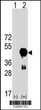Western blot analysis of his-tag PRSS22 (arrow) using his tag antibody. 293 cell lysates (2 ug/lane) either nontransfected (Lane 72) or transiently transfected with thePRSS22 gene.