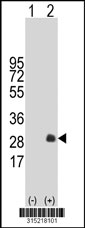 Western blot analysis of his-tag PGF (arrow) using his tag antibody. 293T cell lysates (2 ug/lane) either nontransfected (Lane 1) or transiently transfected with the PGF gene‘