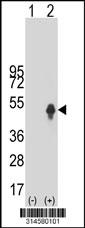 Western blot analysis of his-tag NSMCE4A (arrow) using his tag antibody. 293 cell lysates (2 ug/lane) either nontransfected (Lane 40) or transiently transfected with theNSMCE4A gene.