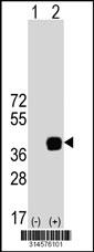 Western blot analysis of his-tag MGLL (arrow) using his tag antibody. 293 cell lysates (2 ug/lane) either nontransfected (Lane 6) or transiently transfected with theMGLL gene.