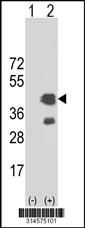 Western blot analysis of his-tag SGTA (arrow) using his tag antibody. 293 cell lysates (2 ug/lane) either nontransfected (Lane 4) or transiently transfected with theSGTA gene.