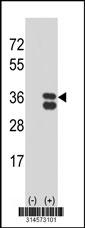 Western blot analysis of his-tag RIBC2 (arrow) using his tag antibody. 293 cell lysates (2 ug/lane) either nontransfected (Lane 24) or transiently transfected with theRIBC2 gene.