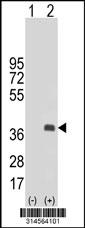 Western blot analysis of his-tag HOXC11 (arrow) using his tag antibody. 293 cell lysates (2 ug/lane) either nontransfected (Lane 12) or transiently transfected with theHOXC11 gene.