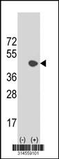Western blot analysis of his-tag SC5DL (arrow) using his tag antibody. 293 cell lysates (2 ug/lane) either nontransfected (Lane 92) or transiently transfected with theSC5DL gene.